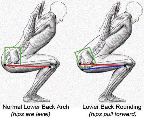 Lower Back Rounding In Bottom Of Squat Butt-Winking